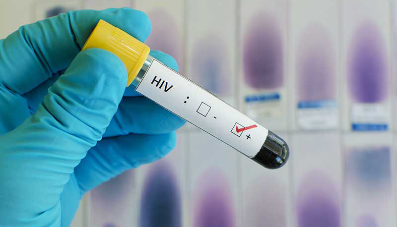 Anvisa registra primeiro teste de farmácia para detecção do HIV